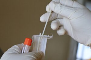 RAPID TESTS