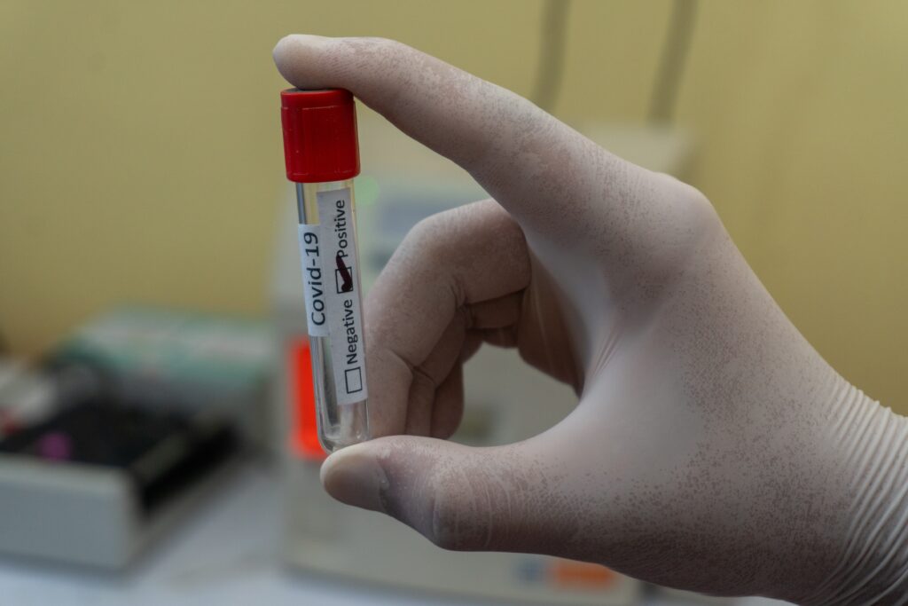 RAPID TESTS ΔΗΜΟΣ ΘΗΒΑΙΩΝ